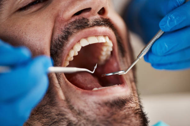 Best After-Hours Emergency Dentist in University Of Virginia, VA