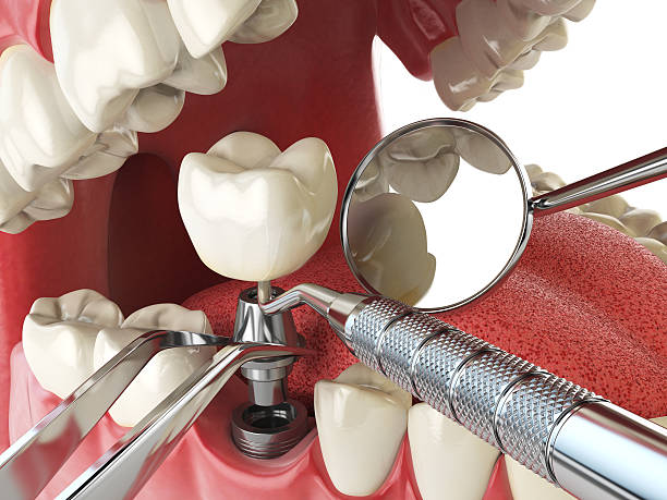 Best Weekend Emergency Dentist in University Of Virginia, VA